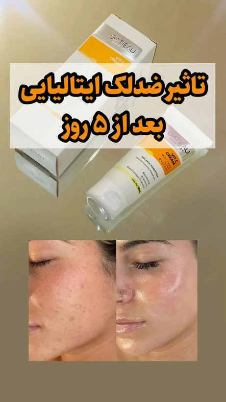 ویتامین سی روشن کننده وسفت کننده پوست شما باضمانتنامه اصل بودن