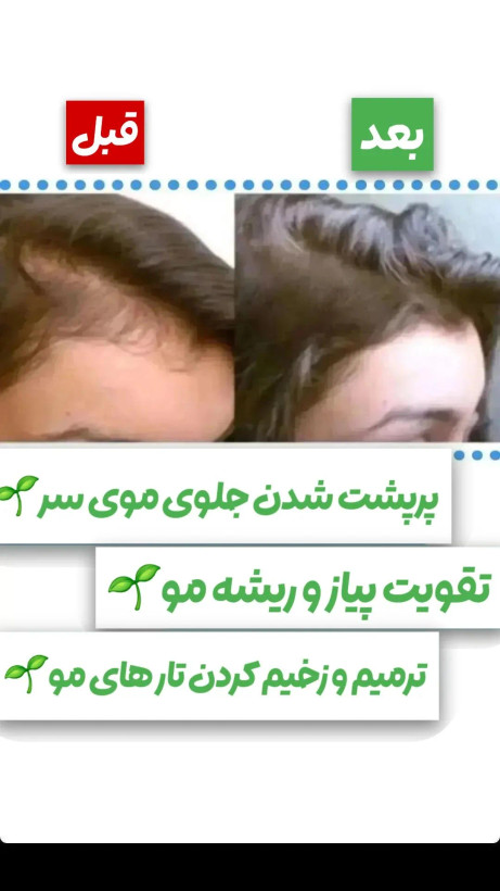 تونیک ضد ریزش و پرپشتی مو باضمانتنامه اصل بودن