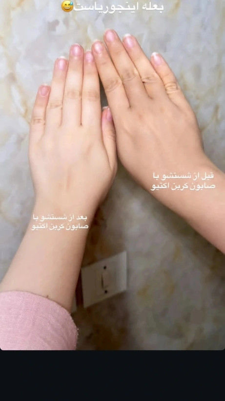 صابون سیاه کربن روشن کننده سریع باضمانت اصل