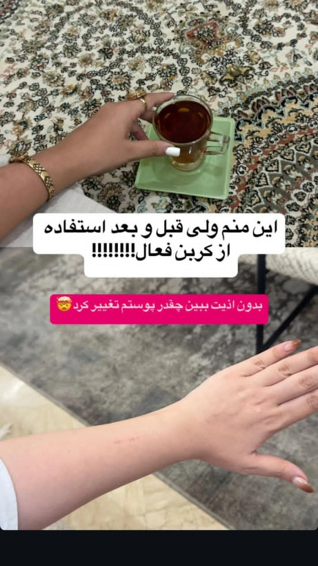 صابون سیاه کربن روشن کننده سریع باضمانت اصل