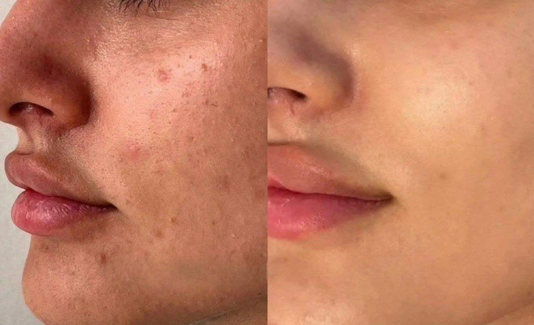 کرم بیوممتیک ترمیم کننده گاتیو اصلی باضمانتنامه